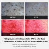 Medicube - Red Succinic Acid Peeling Pads (70 Pads)