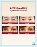 K-Secret Seoul 1988 Eye Cream Retinal Liposome 4% + Fermented Bean 30ml