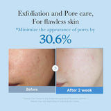 Medicube - Zero Pore Toner 250ml